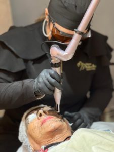 hollywood peel